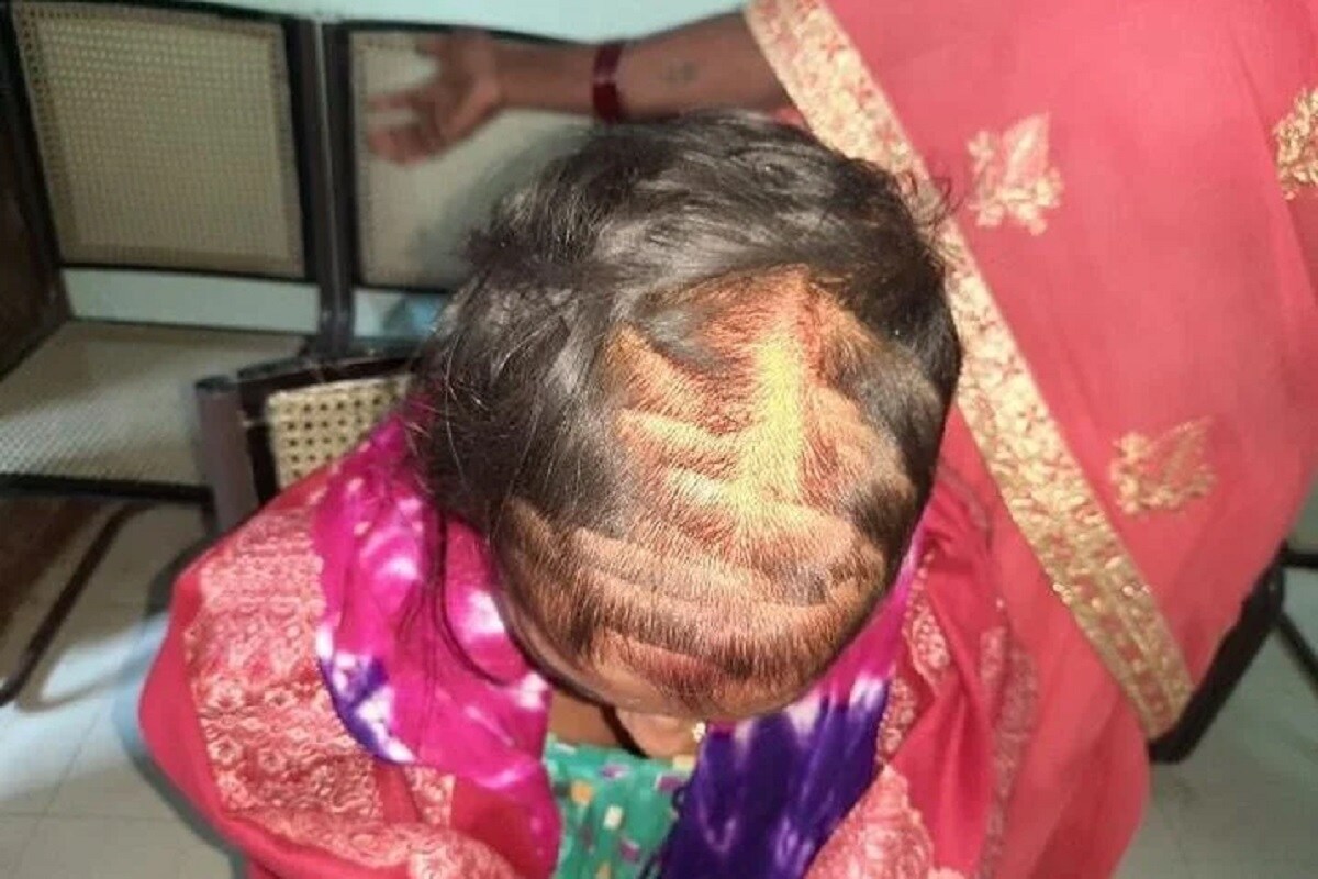 નાલંદામાં આ ઘટના ચર્ચાનો વિષય બની ગઈ છે. આ અંગેની જાણકારી મળતા જ પોલીસ ઘટના સ્થળે પહોંચીને તપાસ શરુ કરી હતી. મળતી માહિતી પ્રમાણે લગ્ન પહેલા આરોપી યુવતી અને આ યુવક વચ્ચે અફેર (love affair) ચાલતું હતું. પરંતુ એક ડિસેમ્બરે શેખપુરા જિલ્લામાં આ પ્રેમી બીજી યુવતી સાથે લગ્ન કરી લીધી હતી. નાલંદામાં આ ઘટના ચર્ચાનો વિષય બની ગઈ છે. આ અંગેની જાણકારી મળતા જ પોલીસ ઘટના સ્થળે પહોંચીને તપાસ શરુ કરી હતી. મળતી માહિતી પ્રમાણે લગ્ન પહેલા આરોપી યુવતી અને આ યુવક વચ્ચે અફેર (love affair) ચાલતું હતું. પરંતુ એક ડિસેમ્બરે શેખપુરા જિલ્લામાં આ પ્રેમી બીજી યુવતી સાથે લગ્ન કરી લીધી હતી.