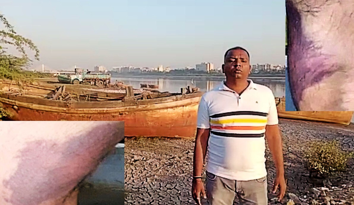 કિર્તેશ પટેલ, સુરત : સુરત પોલીસ (Surat Police) આમતો ગુનાખોરી ડામવામાં નિષ્ફળ નીવડી છે ત્યારે ગુનાખોરી કરતા અથવા ગેરકાયદેસરની પ્રવૃત્તિ કરતા લોકોનો એક યુવકે વીડિયો બનાવી વાઇરલ (Viral Video) કર્યો હતો જોકે આ મામલે વીડિયો વાઇરલ કરનાર યુવાનને પોલીસ બળજબરીથી પોલીસ મથકે લઇ જઈ અને વીડિયો વાઇરલ કરવાની સજા રૂપે (Police Beaten Youth) ઢોર માર માર્યો હતો. જોકે યુવાને સમાજ સેવા કરવી ભરી પડી હતી જોકે આ યુવાને અડાજણ પોલીસ સામે ગંભીર આક્ષેપો કર્યા છે. કિર્તેશ પટેલ, સુરત : સુરત પોલીસ (Surat Police) આમતો ગુનાખોરી ડામવામાં નિષ્ફળ નીવડી છે ત્યારે ગુનાખોરી કરતા અથવા ગેરકાયદેસરની પ્રવૃત્તિ કરતા લોકોનો એક યુવકે વીડિયો બનાવી વાઇરલ (Viral Video) કર્યો હતો જોકે આ મામલે વીડિયો વાઇરલ કરનાર યુવાનને પોલીસ બળજબરીથી પોલીસ મથકે લઇ જઈ અને વીડિયો વાઇરલ કરવાની સજા રૂપે (Police Beaten Youth) ઢોર માર માર્યો હતો. જોકે યુવાને સમાજ સેવા કરવી ભરી પડી હતી જોકે આ યુવાને અડાજણ પોલીસ સામે ગંભીર આક્ષેપો કર્યા છે.