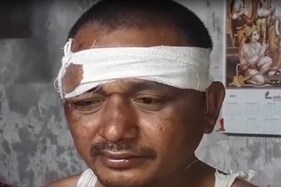 સુરત : અસામાજિક તત્વો TRB જવાન પર તૂટી પડ્યા! ઢોર માર મારી માથું ફોડી નાખ્યું