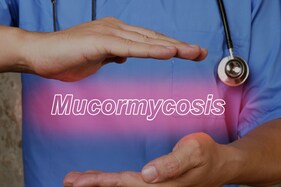 અમદાવાદમાં કોરોનાની સાથે મ્યુકોરમાઇકોસિસનાં કેસમાં પણ ઘટાડો, બે મહિનામાં 984 દર્દીઓની થઇ સારવાર