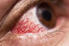 સુરત : કોરોના બાદ હવે મ્યુકોરમાઇકોસિસના પણ વળતાં પાણી, દર્દીઓની સંખ્યામાં સતત ઘટાડો