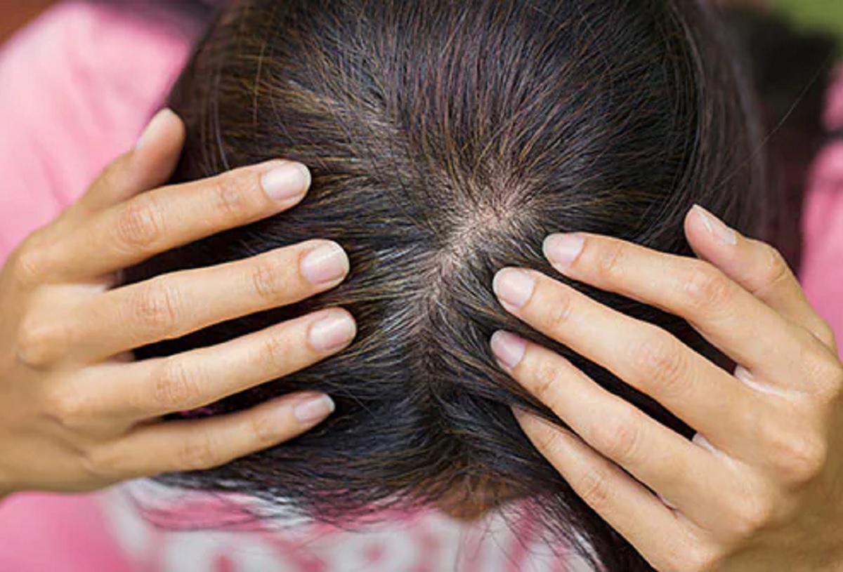 grey hair problem solution home remedies natural beauty care News18 Gujarati grey hair problem solution home remedies natural beauty care News18 Gujarati
