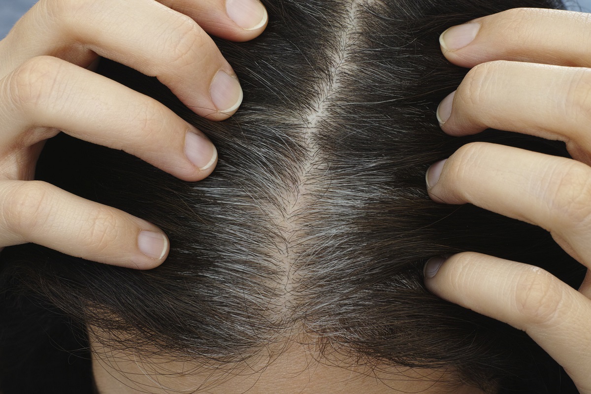 grey hair problem solution home remedies natural beauty care News18 Gujarati grey hair problem solution home remedies natural beauty care News18 Gujarati