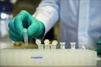 બ્રિટિશ વૈજ્ઞાનિકોની નવી શોધ, આ ટેસ્ટમાં માત્ર 3 મિનિટમાં જાણી શકાશે કે કોરોના થયો છે કે નહીં