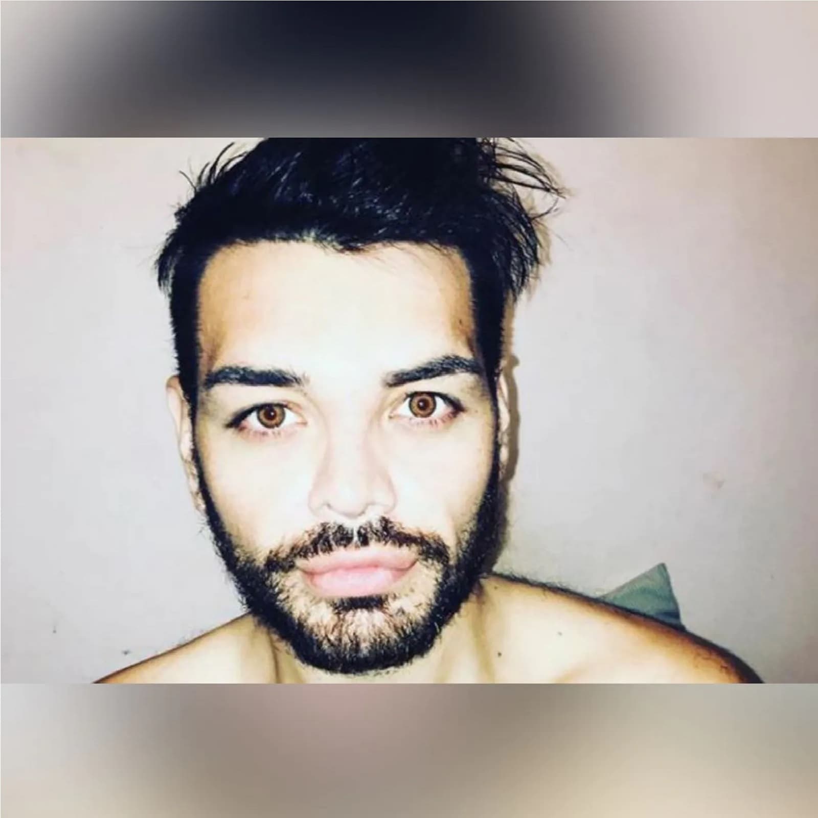 Man had 30 face surgery to look like Ricky Martin
