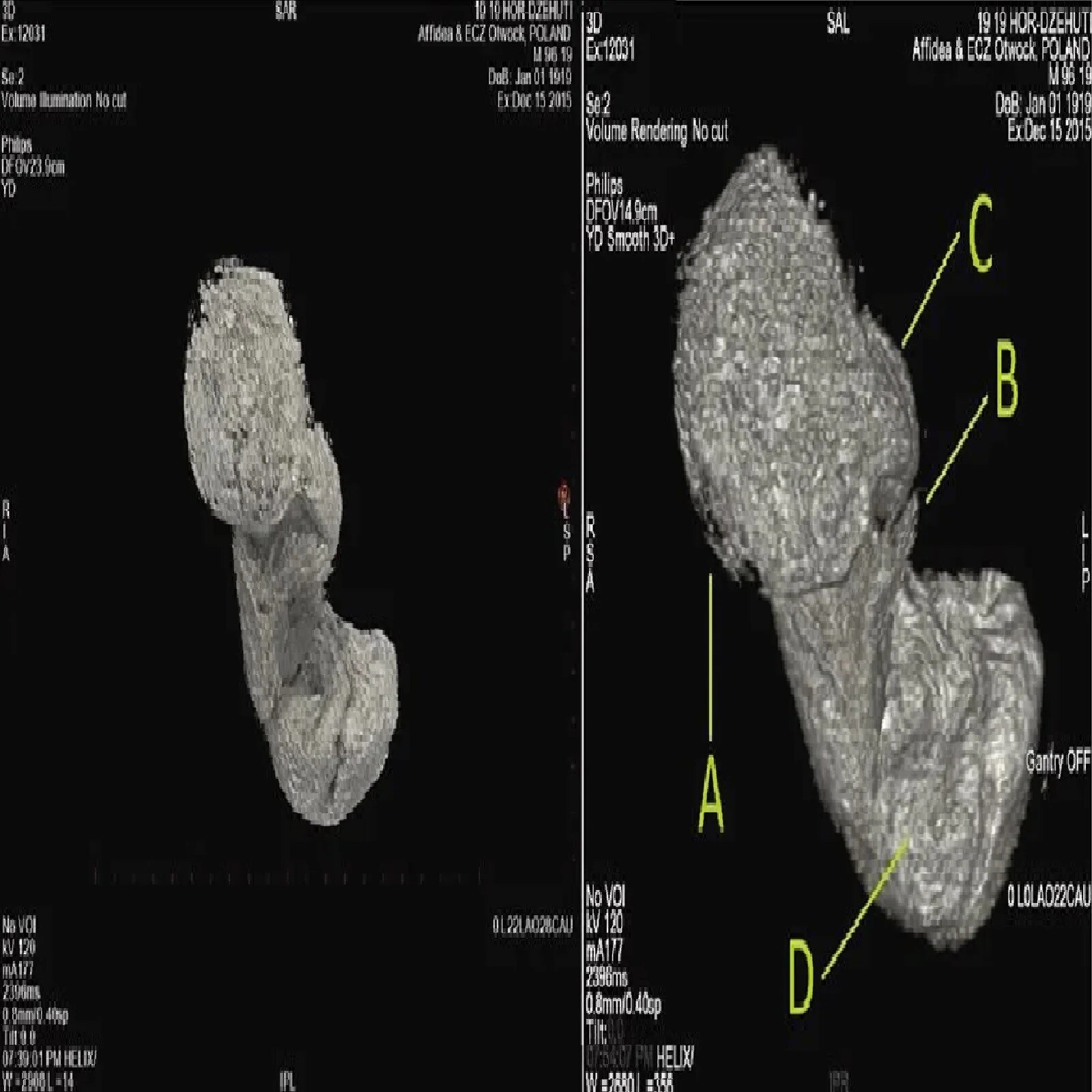World's first pregnant Egyptian mummy