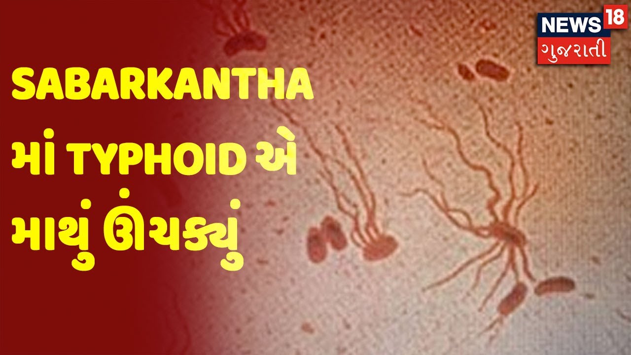 Sabarkantha માં Typhoid એ માથું ઊંચક્યું