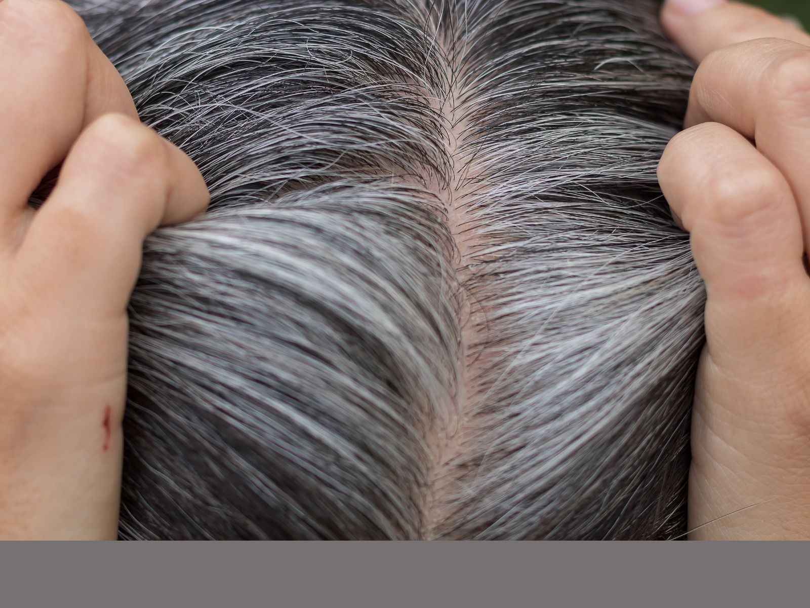 White Hair Home Remedy in Gujarati | સફેદ વાળથી કુદરતી રીતે મેળવો છુટકારો, લગાવો દૂધીનો રસ, જાણો અન્ય ફાયદાઓ વિશે – News18 Gujarati White Hair Home Remedy in Gujarati | સફેદ વાળથી કુદરતી રીતે મેળવો છુટકારો, લગાવો દૂધીનો રસ, જાણો અન્ય ફાયદાઓ વિશે – News18 Gujarati