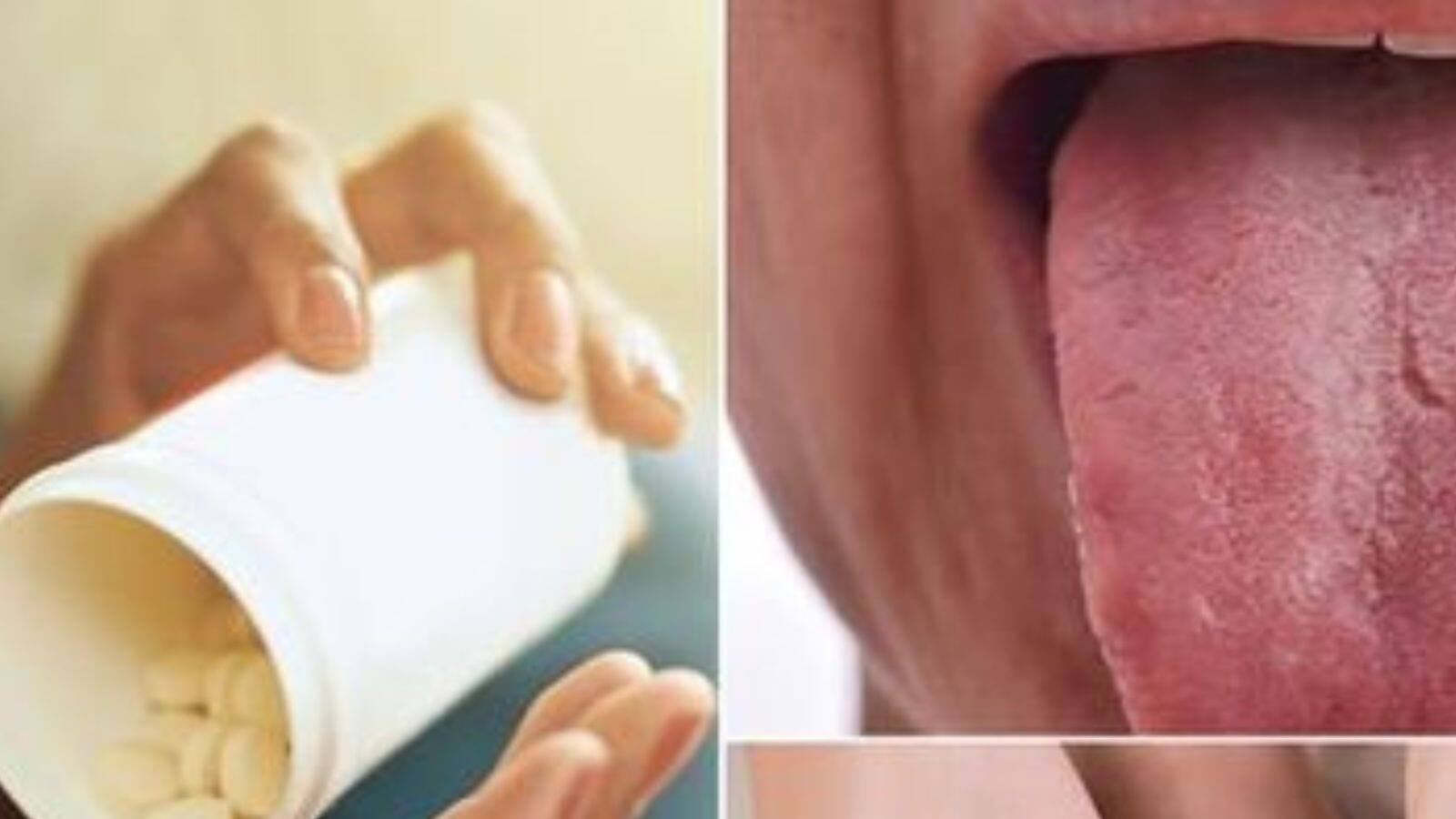 Vitamin b12 deficiency in your body; Check here જાણો શરીરમાં વિટામીન