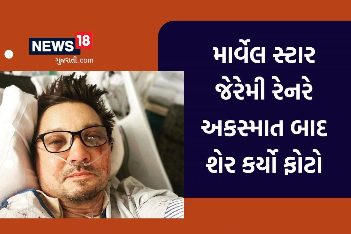 Jeremy Renner: માર્વેલના સુપરહીરોએ અકસ્માત બાદ શેર કર્યો પહેલો ફોટો, ઇજાથી ખરાબ થઈ ગયો ચહેરો