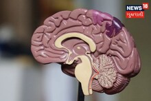 Brain Stroke: Why the problem of brain stroke increases in winter, know all the information