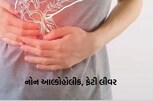 આ બીમારી લીવરને સાવ ખોખલી કરી દે છે, જે દારુ ન પીનારાઓને પણ થઈ શકે છેે, જાણો....