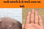 તમારી આંગળી આવી છે? તો તમે જલદી ટકલા થઇ જશો