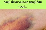 પગમાં પરુ..અને આ લક્ષણો દેખાય તો તરત ડોક્ટર પાસે દોડો, નહીં તો..
