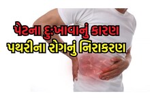 People suffering from stone problem should avoid fast food, drink more water and take Ayurvedic treatment along with it.