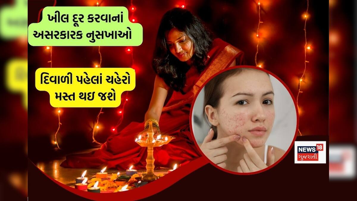 How to get rid of pimples before Diwali દિવાળી પહેલાં આ વસ્તુ ચહેરા