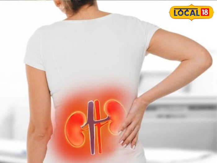     People are seriously victimized by anemia. With further problems you go to the nephrologist, who will examine you hemoglobin, creatinine, urea, sodium, phosphorus, potassium and urine etc. Dialysis can also be done if not affected by drugs.