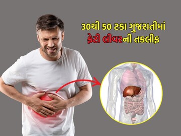 Fatty liver is found in 30 to 50 percent of people in Gujarati