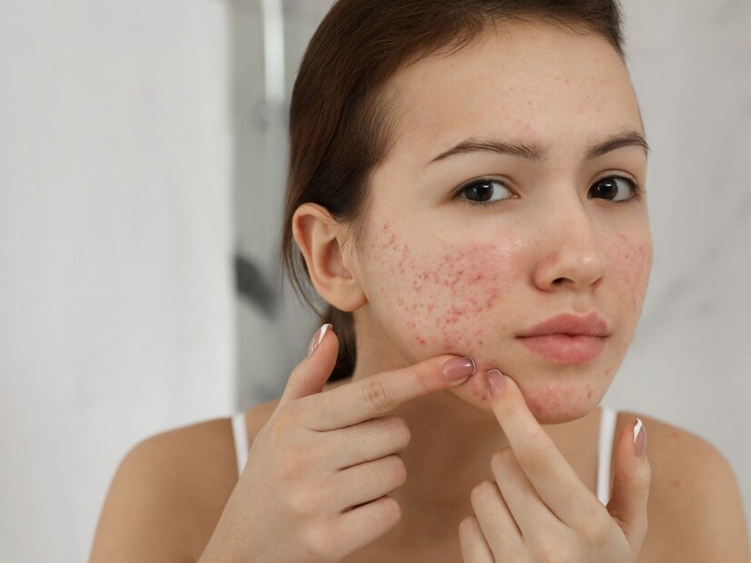Health benefits of use of saliva in the morning pimples will disappear to you abdominal problems and the cracks will heal HC as well.