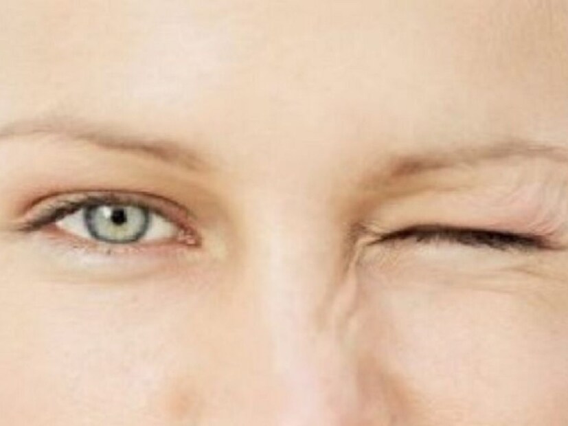     There may also be other reasons for the eye. For example, lack of sleep, excessive stress, fatigue, increase screen time, excessive caffeine intake or dryness in the eyes. But when this problem is frequent, especially with no obvious reason, it can be a sign of severe vitamin B12. Which can prove to be dangerous.