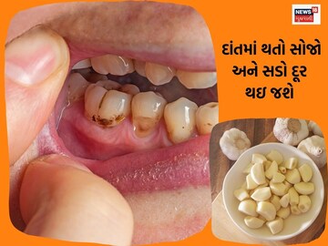 Oral Health needs to be taken care of.