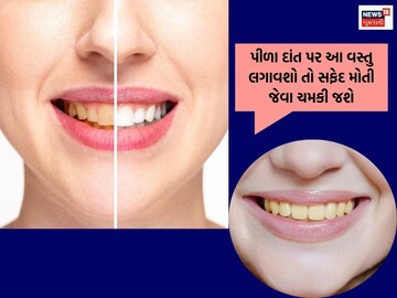 The yellow teeth will shine.