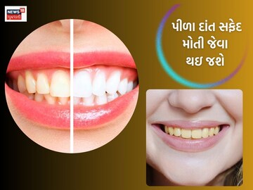 The yellow teeth will shine.