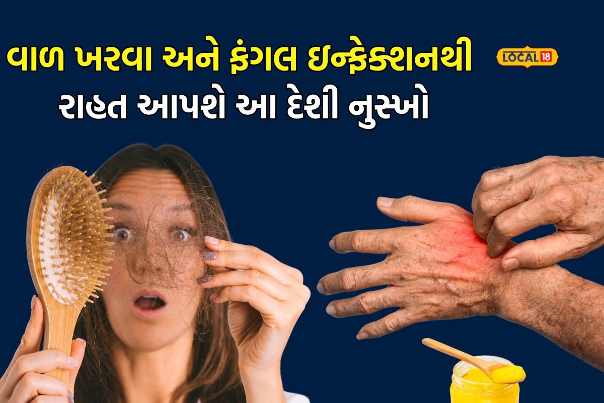 વાળ ખરવા અને ફંગલ ઇન્ફેક્શન સામે અજમાવો દેશી ઘીનો આ સરળ નુસ્ખો