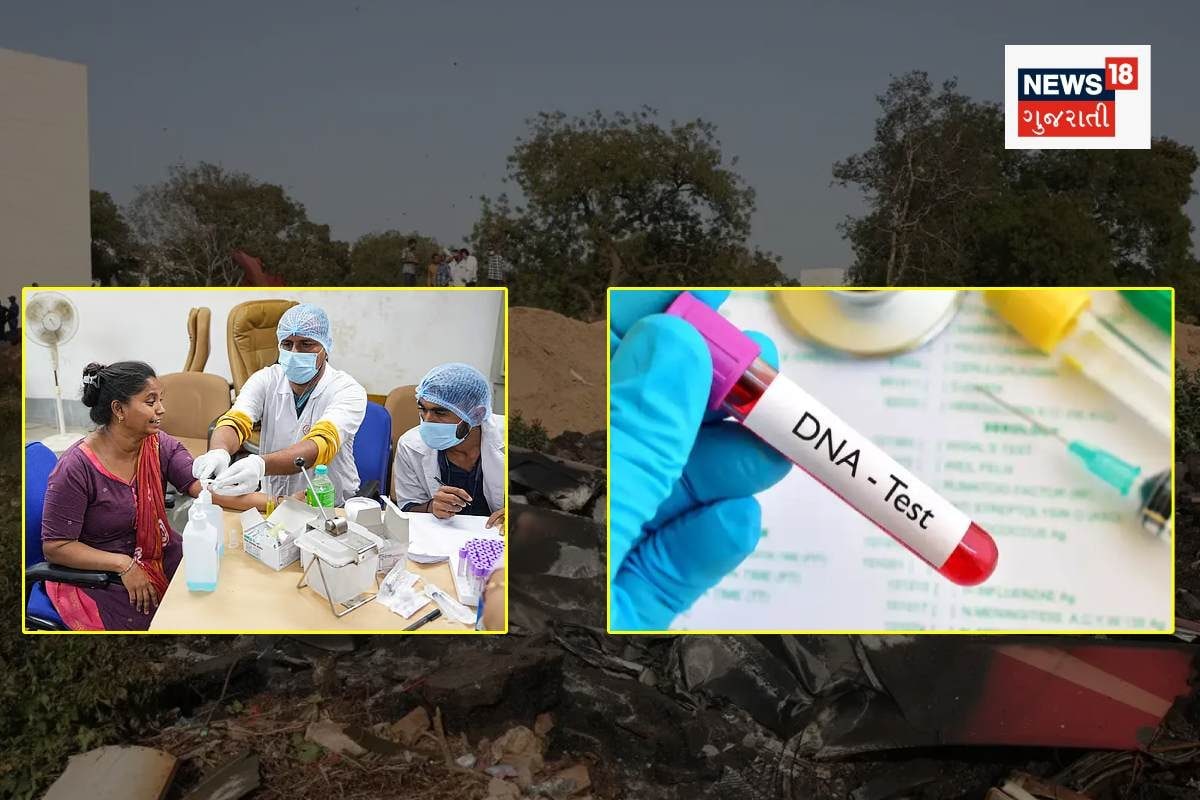 DNA ટેસ્ટિંગમાં આટલો સમય કેમ ? તંત્ર શું કરી રહ્યું છે ? આ સવાલના ચોક્કસ જવાબ જાણો
