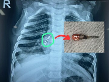 Laljatti Social Case for Parents Laljatti Social Case for Parents