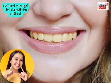 Yellow teeth will be cool.