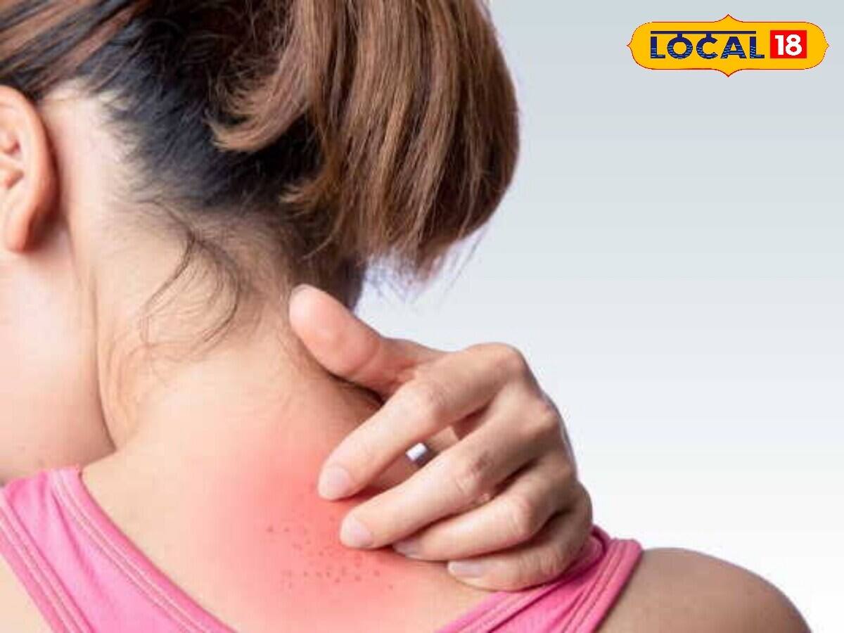 During the monsoon you are troubled by D and Ndraf and skin rash, these 4 home remedies will get you immediate relief.