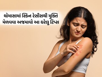 Get rid of skin races in monsoon