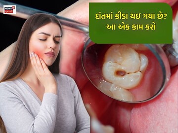 Has the teeth worn? Do this one thing, will always be white like pearls and will not rot!   