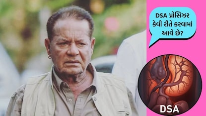 સલીમ ખાન હોસ્પિટલમાં વેન્ટિલેટર સપોર્ટ પર છે.