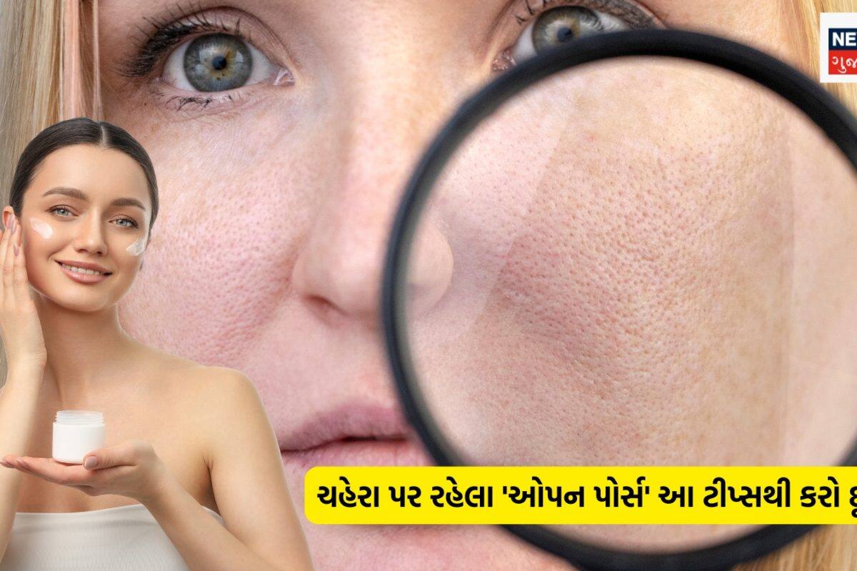 Skincare Tips: ચહેરા પર રહેલા 'ઓપન પોર્સ'થી પરેશાન છો? બસ ફોલો કરો આ ઘરેલું ટીપ્સ, ત્વચા ચાંદની જેમ ચમકવા લાગશે!