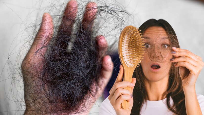 Monsoon Hair Care 5 Superfoods to Stop Hair Fall Naturally in Rainy Season