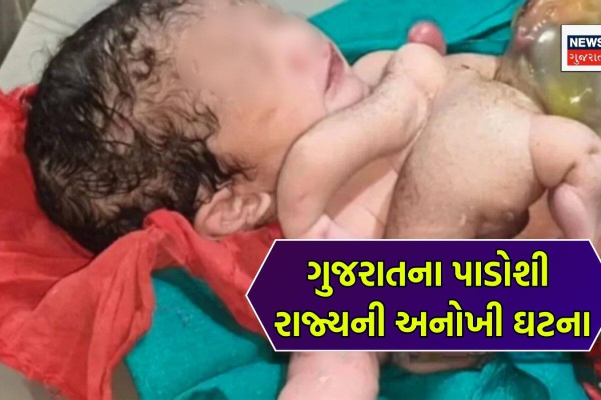 ન હોય! ચાર હાથ-ચાર પગ સાથે બાળકનો જન્મ, શરીર સાથે જોડાયેલું હતું વધારાનું ધડ, ડોક્ટરો પણ ધ્રુજી ગયા!