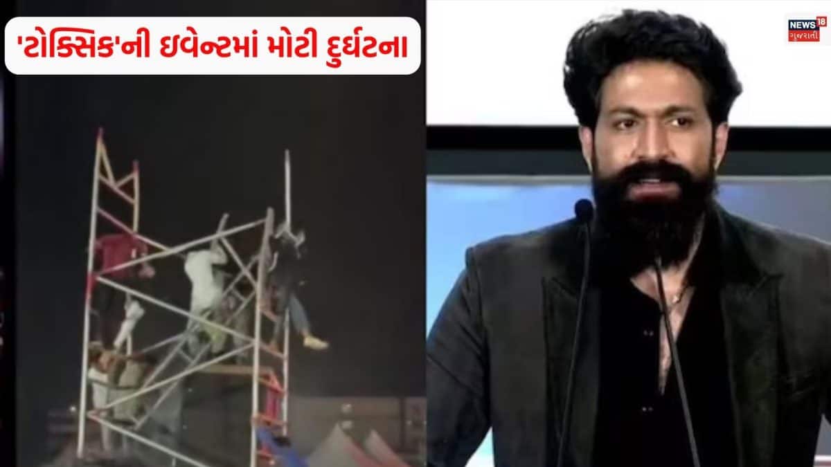 'ટોક્સિક' ઇવેન્ટમાં સાઉન્ડ સિસ્ટમ તૂટી, બે વિદ્યાર્થી ઘાયલ