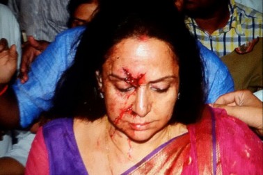 مشہور اداکارہ اور متھرا سے بی جے پی کی ممبر پارلیمنٹ ہیمامالنی کارحادثہ کی زد میں آ گئی ہیں۔ حادثہ میں ہیمامالنی کو شدید چوٹیں آئیں ہیں مشہور اداکارہ اور متھرا سے بی جے پی کی ممبر پارلیمنٹ ہیمامالنی کارحادثہ کی زد میں آ گئی ہیں۔ حادثہ میں ہیمامالنی کو شدید چوٹیں آئیں ہیں