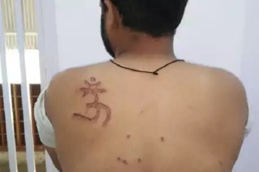 تہاڑ جیل میں حیوانیت ! مسلم قیدی کا الزام ، جیلر نے پیٹھ پر گودا تہاڑ جیل میں حیوانیت ! مسلم قیدی کا الزام ، جیلر نے پیٹھ پر گودا