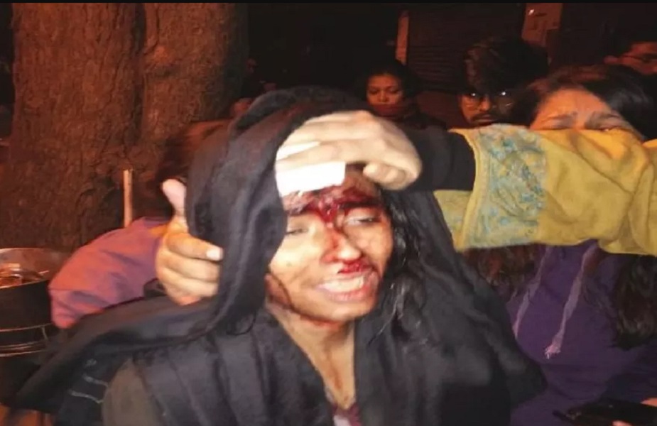 نقاب پوشوں کے حملہ میں زخمی طلبہ تنظیم کی صدر آئشی گھوش نے میڈیا کو بتایا کہ ان پر حملہ کیا گیا ۔ گھوش نے کہا کہ میرے اوپر نقاب پہنے غنڈوں نے بے رحمی سے حملہ کیا ۔ میرے سر پر چوٹ آئی ہیں ۔ میرا خون بہہ رہا ہے ۔ نقاب پوشوں نے بے رحمی سے میری پٹائی کی ۔ نقاب پوشوں کے حملہ میں زخمی طلبہ تنظیم کی صدر آئشی گھوش نے میڈیا کو بتایا کہ ان پر حملہ کیا گیا ۔ گھوش نے کہا کہ میرے اوپر نقاب پہنے غنڈوں نے بے رحمی سے حملہ کیا ۔ میرے سر پر چوٹ آئی ہیں ۔ میرا خون بہہ رہا ہے ۔ نقاب پوشوں نے بے رحمی سے میری پٹائی کی ۔