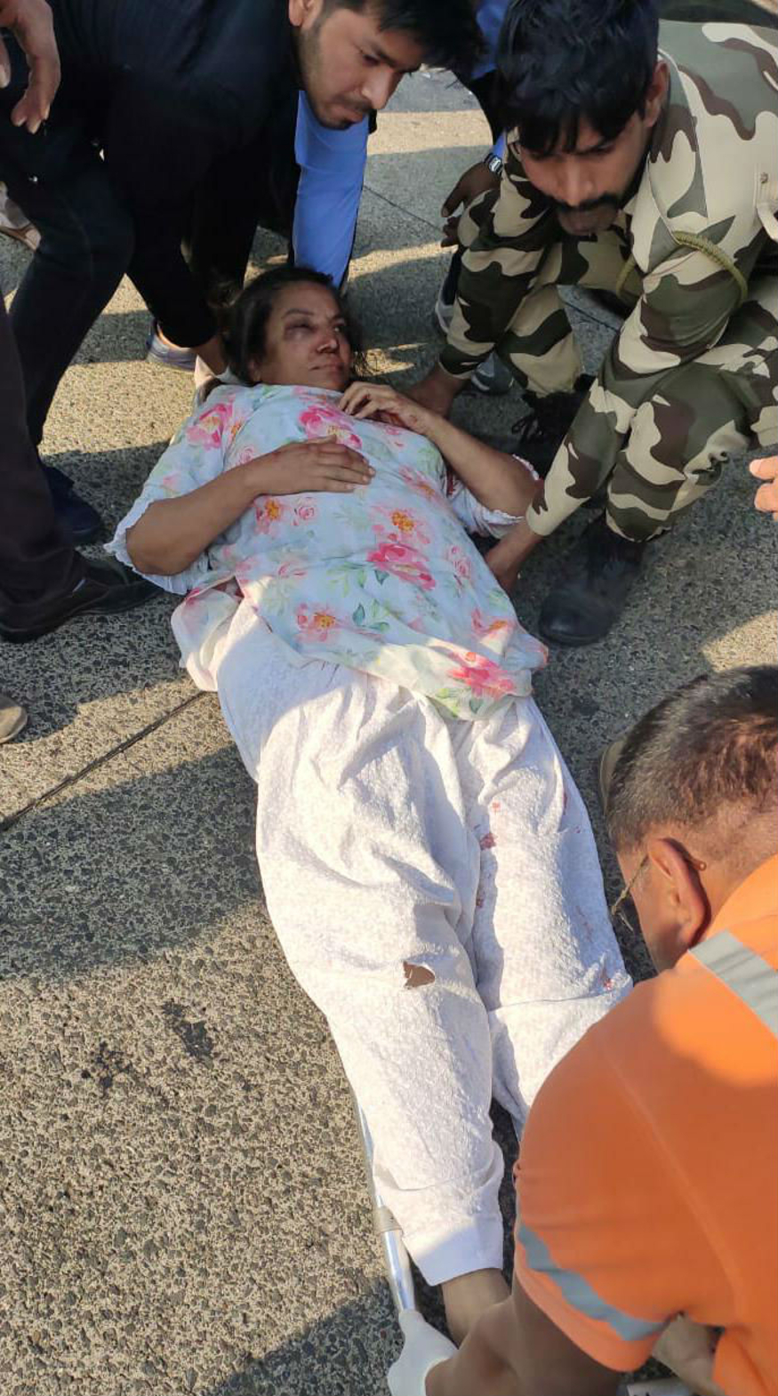 تاہم اس حادثہ میں جاوید اختر بال بال بچ گئے ، لیکن شبانہ اعظم کو چہرے اور ہاتھ میں کافی چوٹیں آئی ہیں ۔ تاہم اس حادثہ میں جاوید اختر بال بال بچ گئے ، لیکن شبانہ اعظم کو چہرے اور ہاتھ میں کافی چوٹیں آئی ہیں ۔