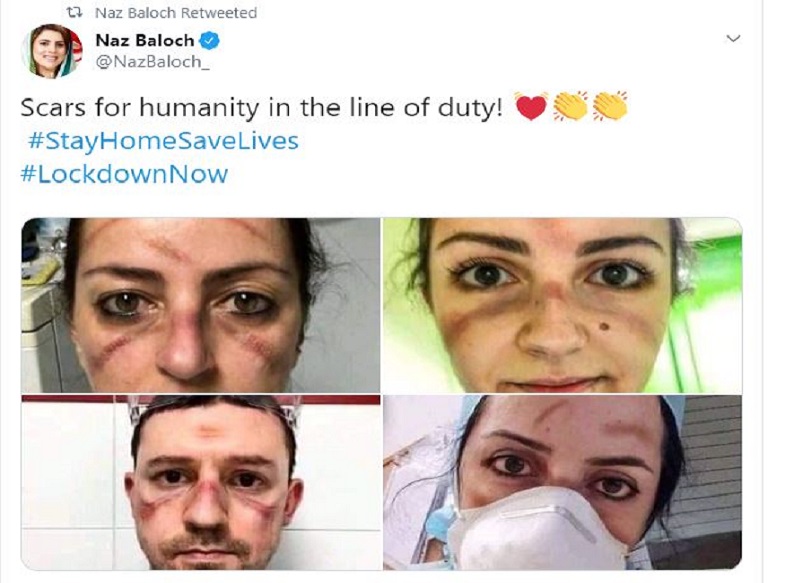 <br />ان کی اس پوسٹ پر کئی لوگوں کے کمینٹ آئے، یوزرس نے ان ڈاکٹر اور نرس کو سیلیوٹ کیا۔ ایک یوزر نے لکھا خدا ان کے ساتھ ہے <br />ان کی اس پوسٹ پر کئی لوگوں کے کمینٹ آئے، یوزرس نے ان ڈاکٹر اور نرس کو سیلیوٹ کیا۔ ایک یوزر نے لکھا خدا ان کے ساتھ ہے