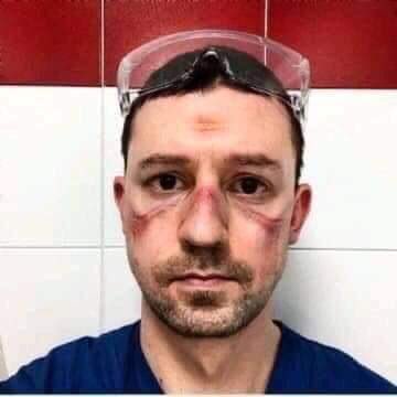 <br />ان تصویروں کو پاکستان کی رکن پارلیمنٹ ناز بلوچ نے اپنے ٹویٹر اکاؤنٹ پر شیئرکیا ہے۔ انہوں نے لکھا Scars for humanity in the line of duty۔ ناز نے ان ڈاکٹروں اور نرسوں کے حوصلےکو سلام کیا۔ <br />ان تصویروں کو پاکستان کی رکن پارلیمنٹ ناز بلوچ نے اپنے ٹویٹر اکاؤنٹ پر شیئرکیا ہے۔ انہوں نے لکھا Scars for humanity in the line of duty۔ ناز نے ان ڈاکٹروں اور نرسوں کے حوصلےکو سلام کیا۔