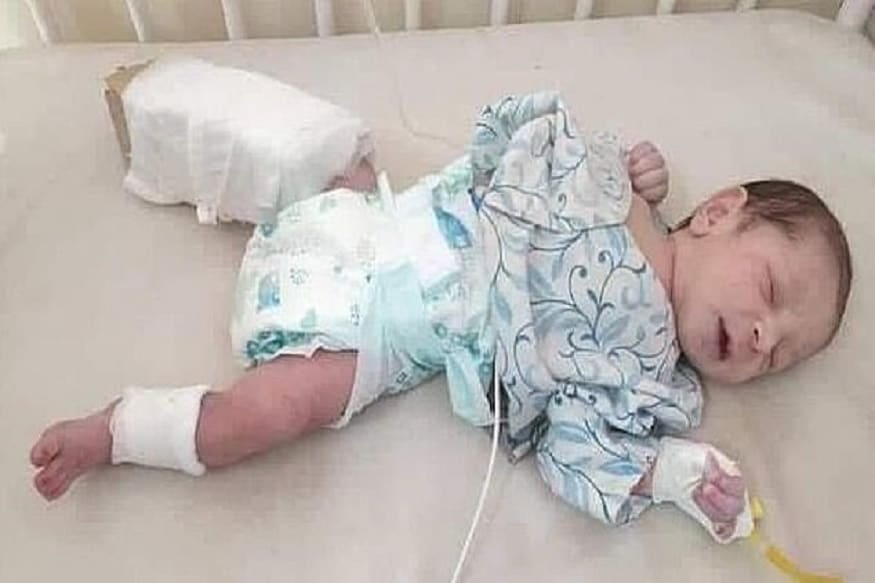 ڈاکٹر نے بچی کینال کاٹنے سے پہلے بچی کو رلانے کی کوشش کی تو اس نے ایسا ردعمل دیا کہ ڈاکٹر بھی حیران رہ گئے۔ بچی کے غصے والی ان تصویروں کو دیکھ کر لوگ اپنی ہنسی نہیں روک پا رہے ہیں۔ ڈاکٹر نے بچی کینال کاٹنے سے پہلے بچی کو رلانے کی کوشش کی تو اس نے ایسا ردعمل دیا کہ ڈاکٹر بھی حیران رہ گئے۔ بچی کے غصے والی ان تصویروں کو دیکھ کر لوگ اپنی ہنسی نہیں روک پا رہے ہیں۔