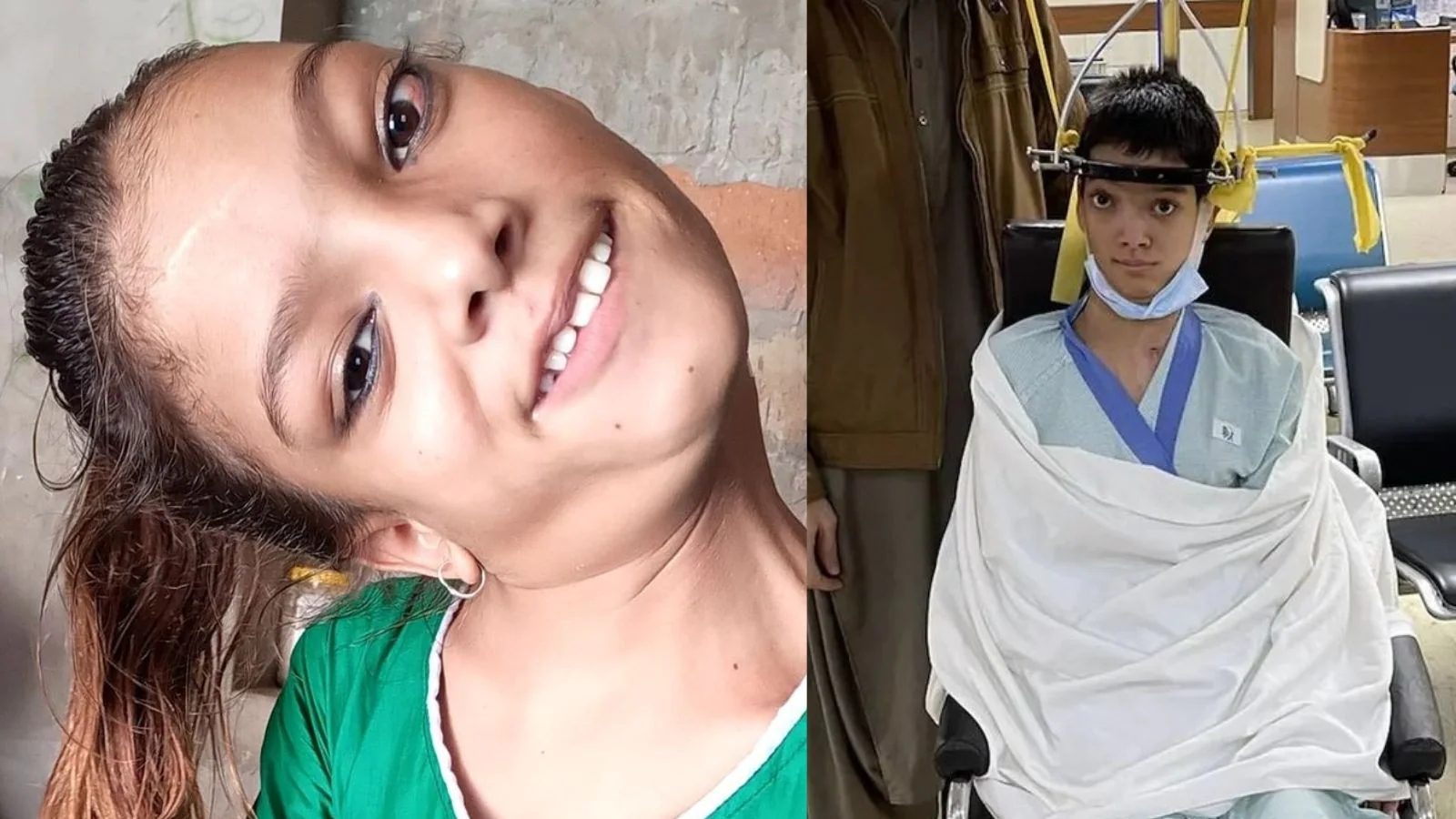 OMG تیرہ سالوں سے گردن کو ایک طرف جھکائے زندگی گزار رہی تھی پاکستانی