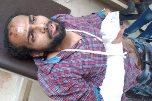 gorakhnath temple attack : گورکھ ناتھ مندر میں داخل ہونے کی ناکام کوشش کے دوران ملزم احمد مرتضیٰ کو بھی شدید چوٹیں آئیں ہے، جسے علاج کے لیے ضلع اسپتال میں داخل کرایا گیا ہے۔ پولیس فی الحال یہ جاننے کی کوشش کر رہی ہے کہ اس حملے کے پیچھے اس کا مقصد کیا تھا۔ ساتھ ہی حملہ آور کی ذہنی حالت کا بھی جائزہ لیا جا رہا ہے۔
