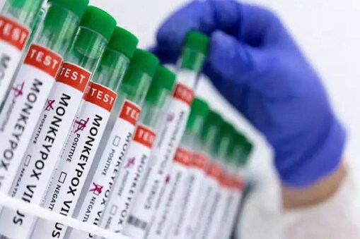 monkeypox vaccine: منکی پاکس کے خطرے کو دیکھتے ہوئے مرکز کا بڑا فیصلہ، ویکسین بنانے کیلئے نکلا ٹینڈر (Reuters)