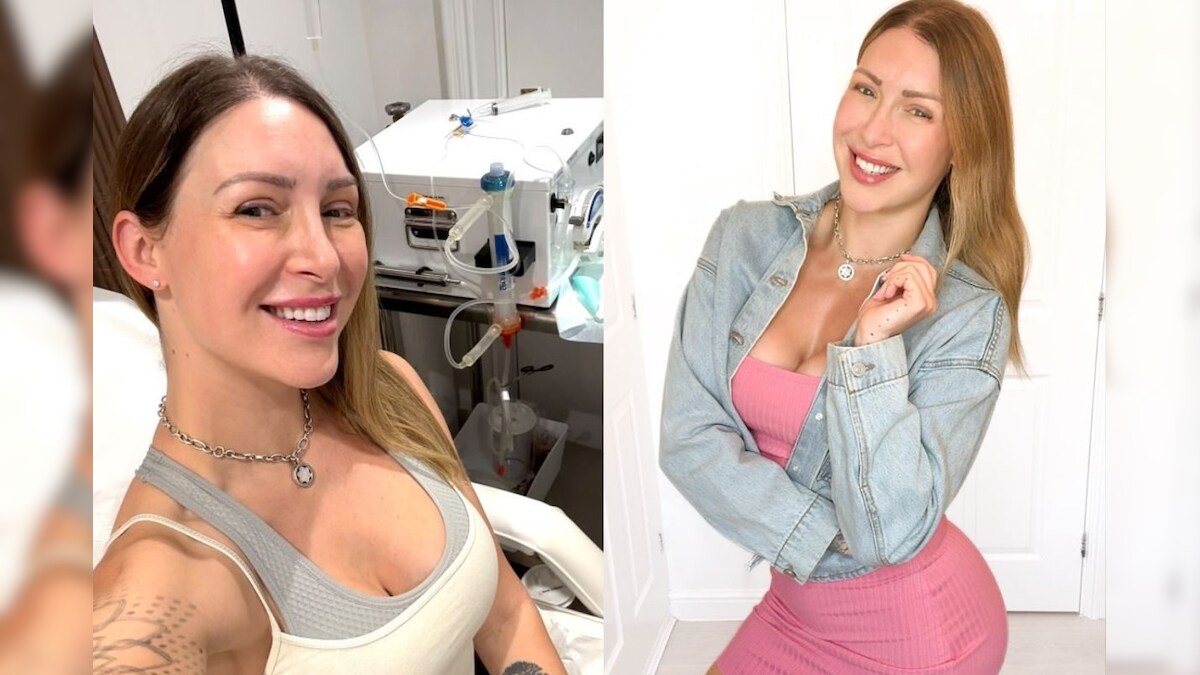 Viral tracy kiss blood filtration for aging backwards like simon cowell